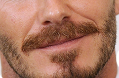 胡須項(xiàng)目示例圖